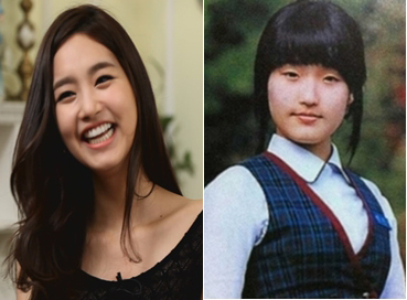 미코 김유미 성형 인정 "이렇게 쿨한 여자를 봤나"