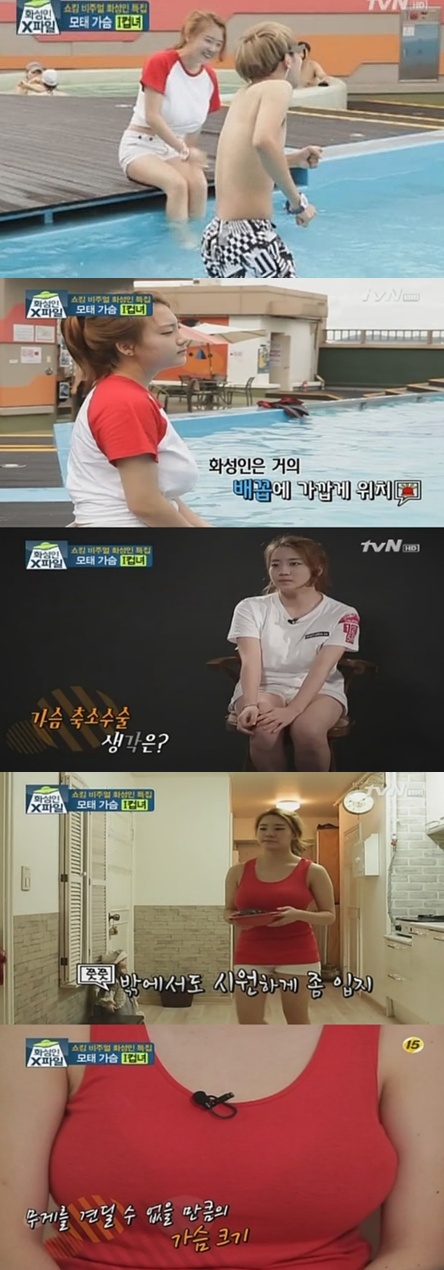 화성인 I컵녀 얼마나 크기에…"허리통증보다 남들 시선에 더 아파"