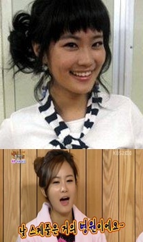김지민 "기타 튜닝하듯…" 성형고백에 정경미 "낮 스케줄은 병원" 폭로