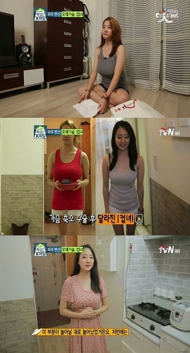 '화성인' I컵녀, B컵 가슴축소수술 감행... 네티즌 상반된 반응