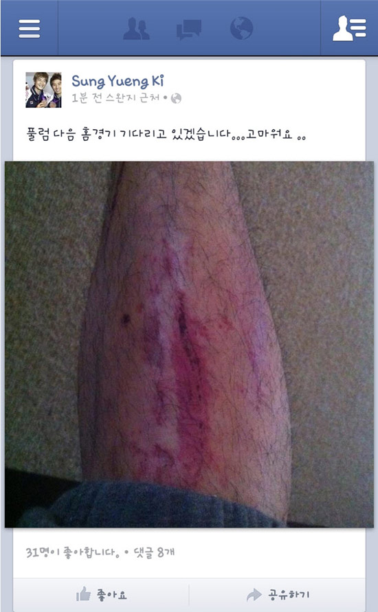 "말이 씨가 됐나~" 기성용 진짜 부상, 정현수 사과글에도 불구 비난 폭주