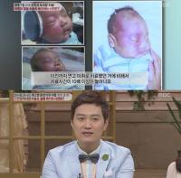 문천식 가슴 아픈 육아스토리…"화염상 모반으로 7차례 수술"
