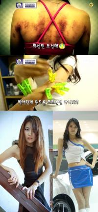 '수지 닮은꼴' 김수아 방송 조작 논란 "노출 많은 레이싱걸 몸에 피멍?"