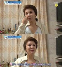 김세레나 보톡스 중독 "예뻐지려 맞았다가 얼굴 울퉁불퉁"