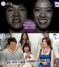 '렛미인3' 주걱턱녀, 역대 최대 반전? '얼마나 변했길래...'