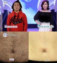 '렛미인' 털많은 여자, 생리 끊기고 배 가슴에 털이 '수북'… 변신 결과는?