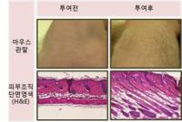 메디포스트, 산업부 '줄기세포 발모제' 연구기관 선정
