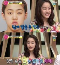 '턱주가리녀' 허예은 180도 달라진 외모-삶…"숨 쉬기도 힘들었다"