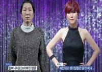 '렛미인' 노안녀, 20대 할머니의 대반전…"수술비만 1억이라니"