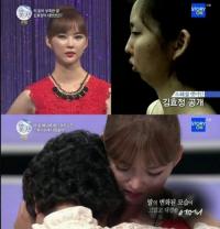 렛미인 김효정, 무턱 교정으로 브이라인 미녀 재탄생…어머니와 눈물의 포옹