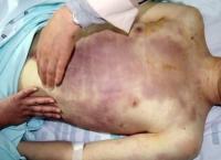 윤일병 가해병사 살인죄 적용 "살인의 미필적 고의 인정" 재판부 판단은?
