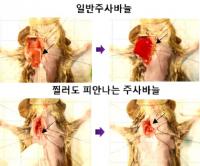 피나오지 않는 주사바늘 나왔다