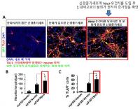신경줄기세포 분화조절 단백질 발견…"뇌발달 장애치료 기대"