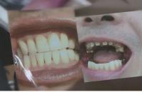 ‘궁금한 이야기Y’ 양도 받은 치과에서 벌어진 일, 큰 상해 입은 환자가 받는 치료를...