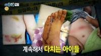 '실화탐사대' 아이들 덮친 세면대, 피해 부모 "배 갈라져 끔찍했다"