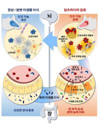 장내 미생물로 알츠하이머 완화 가능성 제시