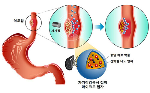 식도 환경에서 단백질 마이크로입자의 자기장 감응성 및 접착성을 이용한항암 약물치료 모식도 (자료=포스텍 제공)