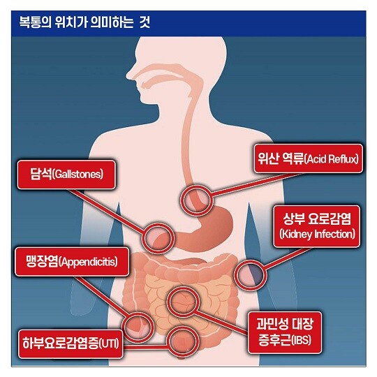 복통의 원인은 통증이 발생한 부위에 따라 다르다. 자료=데일리메일